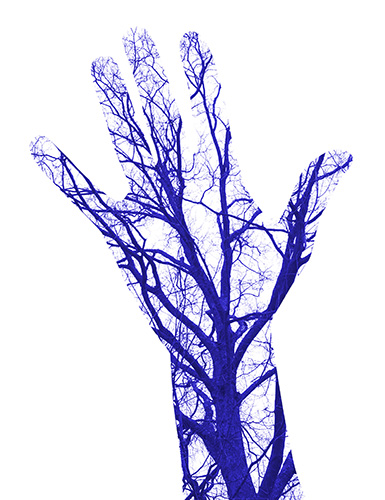 Darstellung der Handvenen